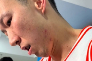 周琦談夏天打針治療腰傷：這次數(shù)量&劑量更大 目前來講恢復得不錯