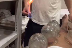 嘗試東方神秘力量！北京男籃外援斯佩爾曼曬拔火罐視頻