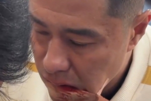 硬漢！國安足協(xié)杯奪冠后，侯森在場邊默默處理嘴部傷口